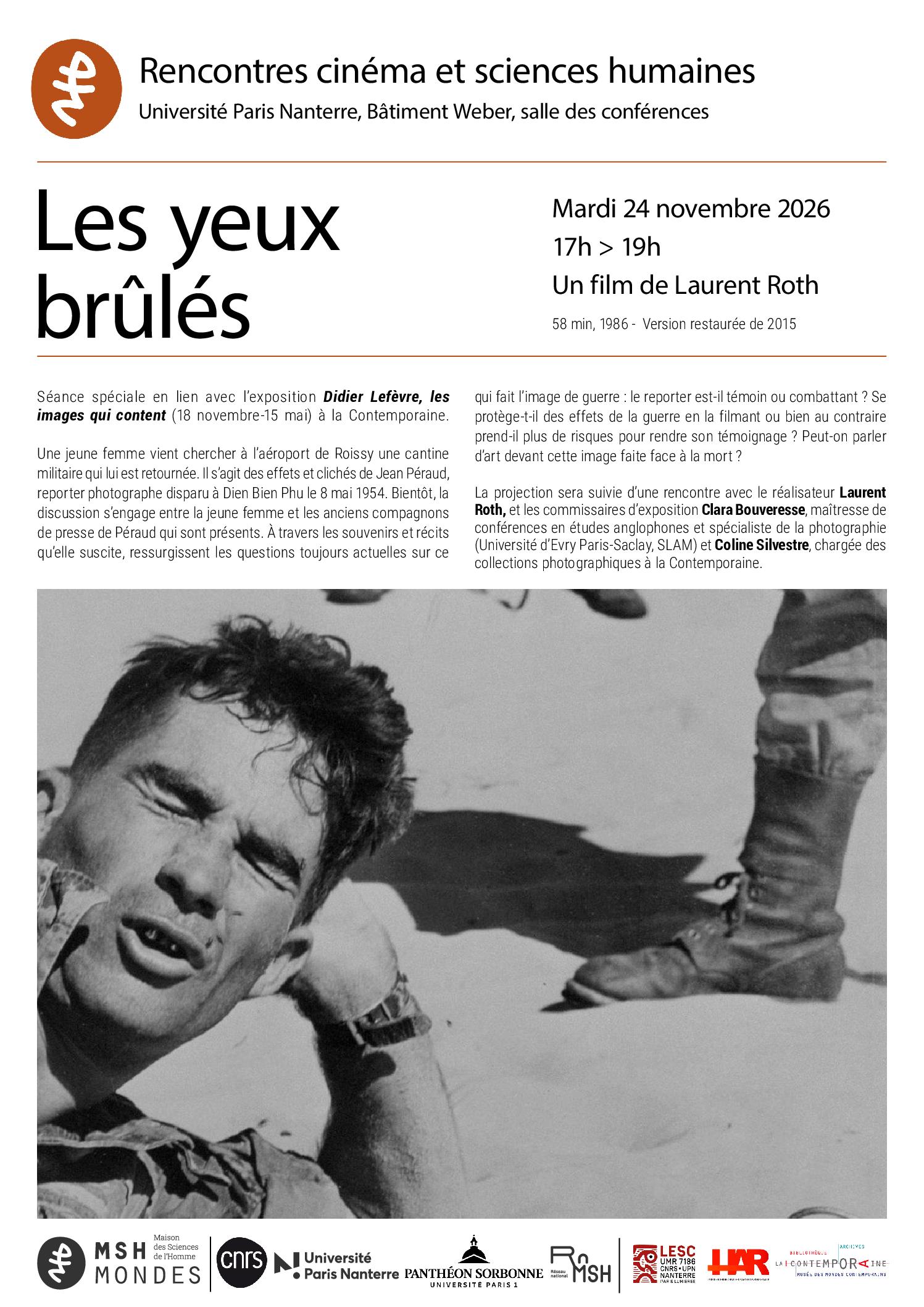 Les yeux brûlés